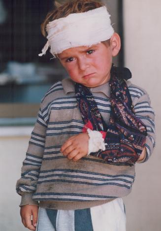 Kurds - Injured Boy at Silopi Refg