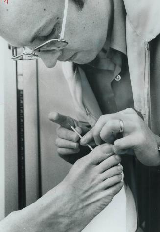 Dr. Marian Zazula treats a patient with back trouble by inserting an acupuncture needle in his toe. The Toronto medical doctor, who spent the summer i(...)