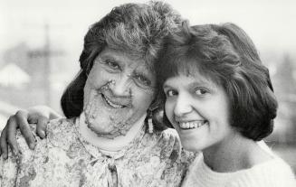 Margaret Muise, left and her daughter Rhonda are victims of neurofibromatosis, also known as the Elephant Man's disease
