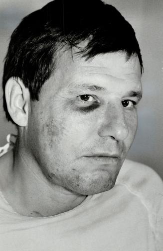 Joe Ogle: Soccer referee is recovering from injuries received when he was attacked by two players in game Monday