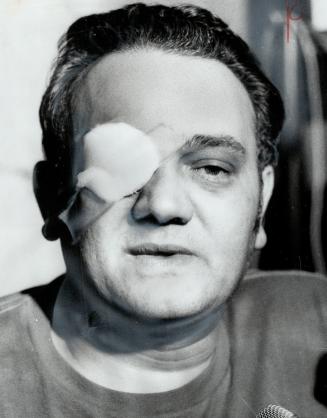 Bus driver Joseph Kiomall wears a patch on injured eye after hijackers poured lighter fluid over him and threatened to set him, his bus and passengers(...)